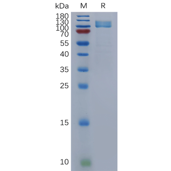 Human SEMA4B Protein, His Tag