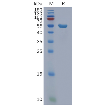 Human SEZ6 Protein, His Tag