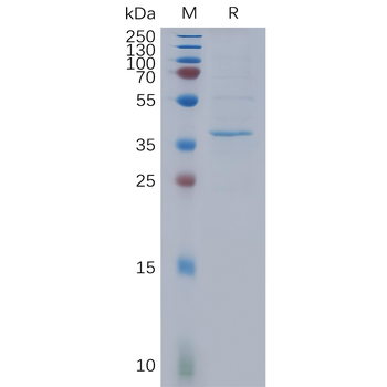 Human CLDN6(138-160) Protein, mFc Tag