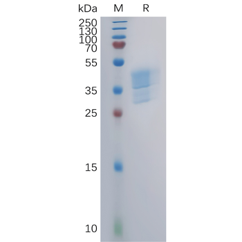 Human CLDN6(138-160) Protein, hFc Tag