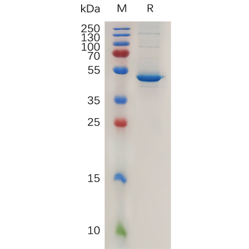 Human PODXL2 Protein, His Tag