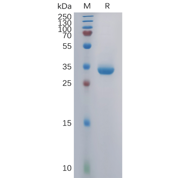 Human CLDN4(145-157) Protein, mFc Tag