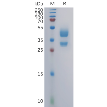 Human FZD7 Protein, hFc Tag