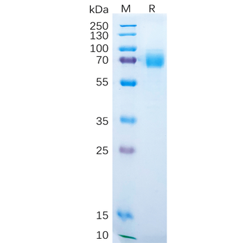Human CD3D Protein, His Tag and Human CD3E Protein, hFc Tag