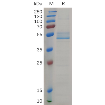 Human CALCA(85-141) Protein, hFc Tag