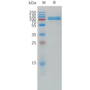 Cynomolgus CDH17 Protein, His Tag
