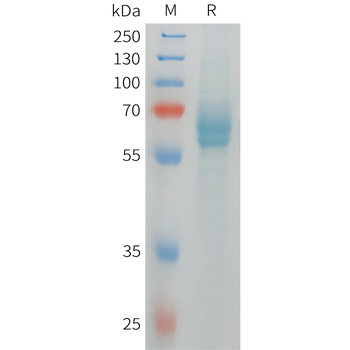 Cynomolgus AXL Protein, His Tag