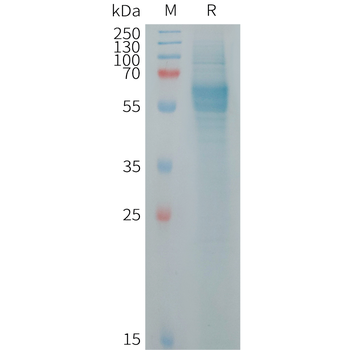 Human LEP Protein, hFc Tag