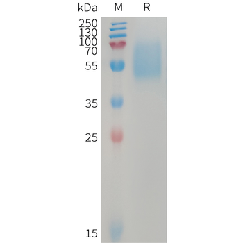 Human CFI Protein, His Tag