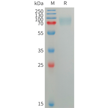 Human CD22(417-678) Protein, mFc Tag