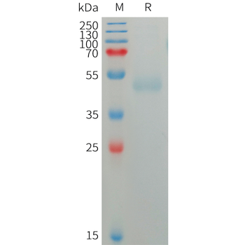 Human CD22(417-678) Protein, hFc Tag