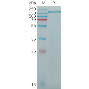 Human OSCAR Protein, His Tag