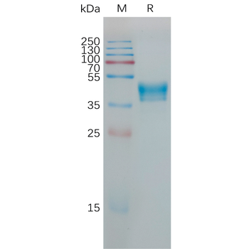 Human CD62E Protein, His Tag
