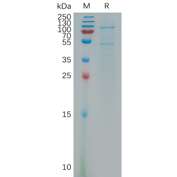 Human TREML2 Protein, His Tag