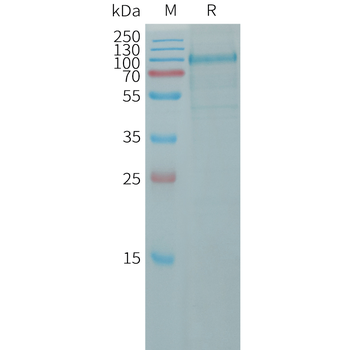 Human LEPR Protein, His Tag