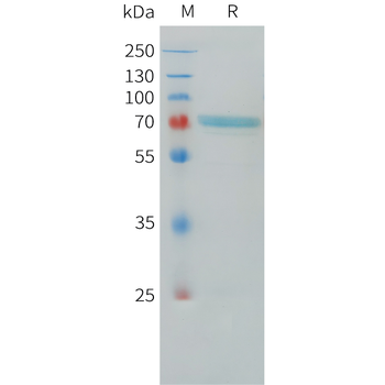 Human C2 Protein, His Tag