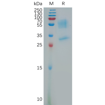 Human FGFR1 Protein, His Tag