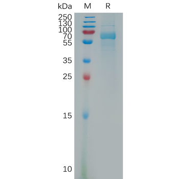 Human PIP Protein, hFc Tag