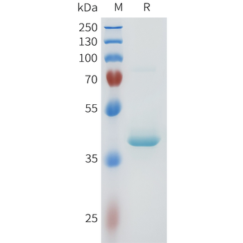 Mouse IL6 Protein, hFc Tag