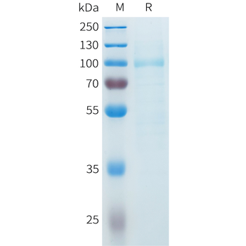 Mouse IGF1 Protein, hFc Tag