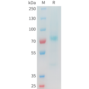 Mouse 5T4 Protein, His Tag