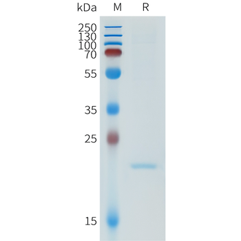 Mouse ICAM1 Protein, His Tag