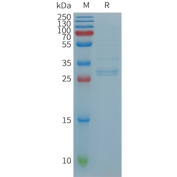 Human PLA2R1(21-521+1097-1246) Protein, His Tag
