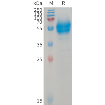 Human PLA2R1(21-164+223-359+1097-1246) Protein, His Tag