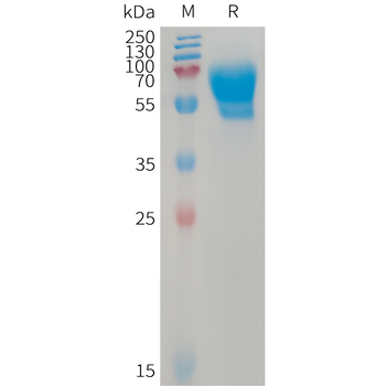 Human PLA2R1 Protein, His Tag