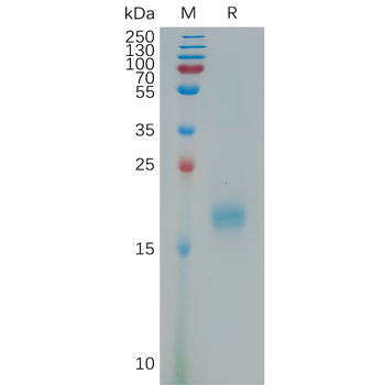 Human MXRA8 Protein, His Tag