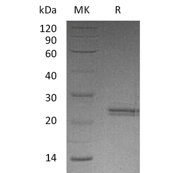 Human CCL11 Protein, hFc Tag