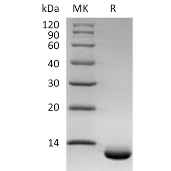 Human CD98 Protein, His Tag