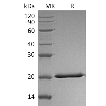 Human PAI1 Protein, His Tag