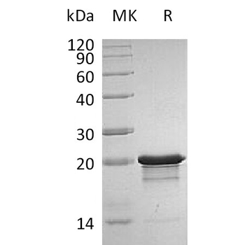 Human GPR64 Protein, His Tag