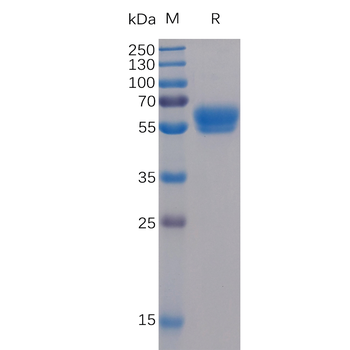 Human CRLF2 Protein, His Tag