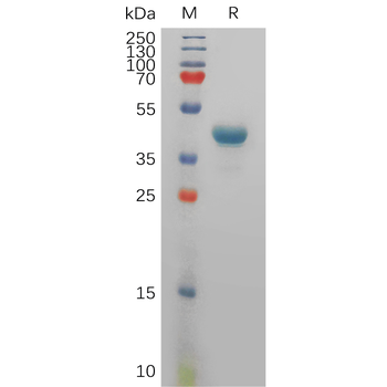 Human AKT1 Protein, His Tag