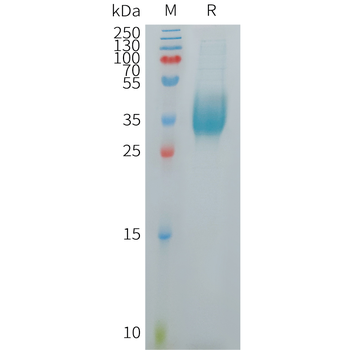 Human CRCP Protein, hFc Tag