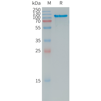 Human TIM4 Protein, His Tag
