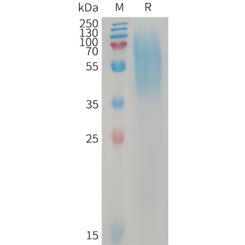 Human C1S Protein, His Tag