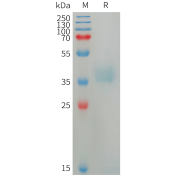 Human PRLR Protein, His Tag