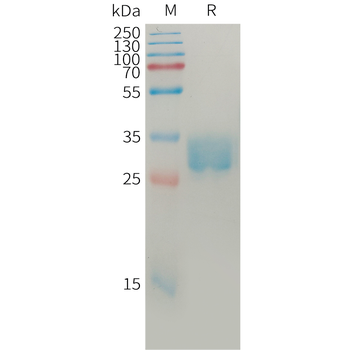 Human PRL Protein, hFc Tag