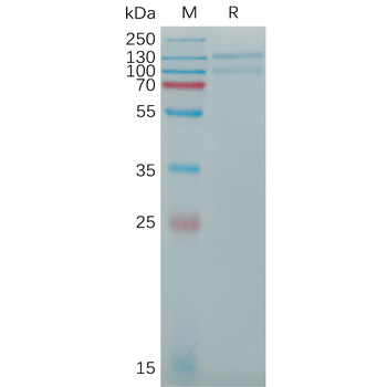 Human ST2 Protein, His Tag