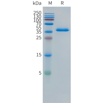 Cynomolgus CD73 Protein, His Tag