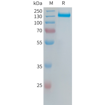 Human IL31 Protein, His Tag