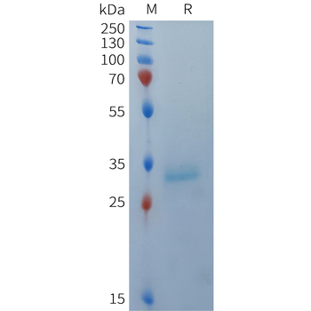 Human IL36G Protein, hFc Tag