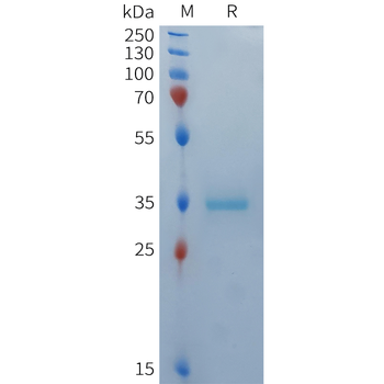 Human IL36A Protein, hFc Tag