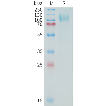 Human CDH17(668-777) Protein, hFc Tag