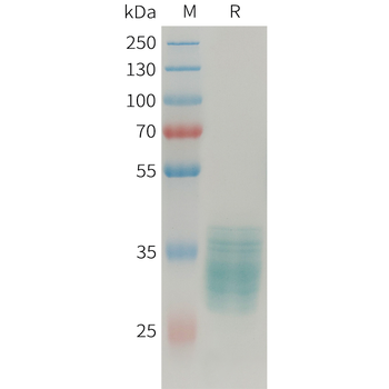 Human CDH17(129-244) Protein, hFc Tag