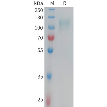 Human APOA1 Protein, His Tag