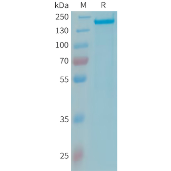 Human CLM5 Protein, hFc Tag